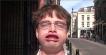 Flapping Our Lips Together In Slow-Mo